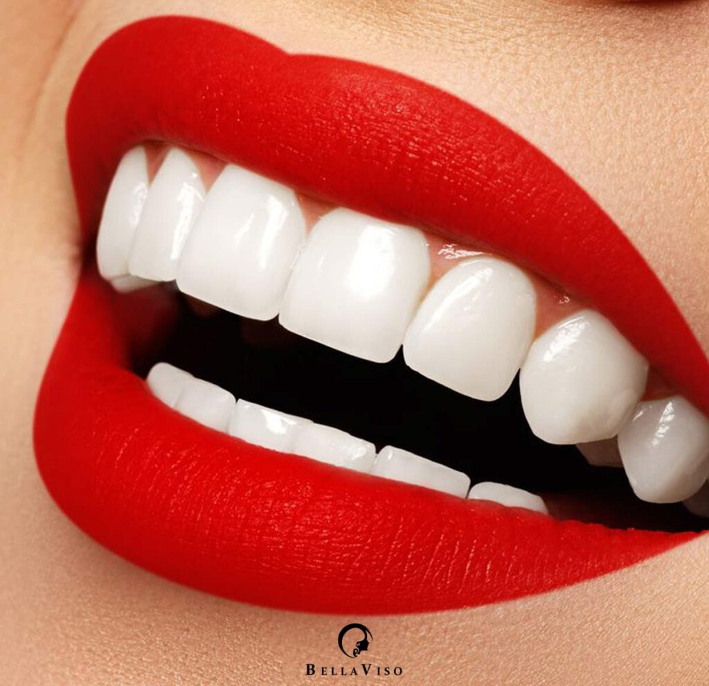 The Ultimate Guide to Teeth Cleaning Price in Abu Dhabi