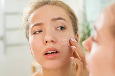 How to Avoid Dry Skin During Winter
