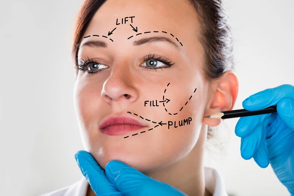 What is facelift surgery? How is it performed?